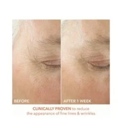 Dr Dennis Gross Alpha Beta Ultra Gentle Daily Peel -Babor Sales Shop Alpha Beta Ultra Gentle Daily Peel add2 65347 812 general