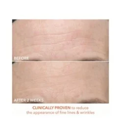 Dr Dennis Gross Alpha Beta Ultra Gentle Daily Peel -Babor Sales Shop Alpha Beta Ultra Gentle Daily Peel add3 65347 7832 general