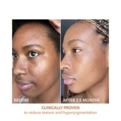 Dr Dennis Gross Alpha Beta Universal Daily Peel -Babor Sales Shop Alpha Beta Universal Daily Peel add4 55577 3617 general